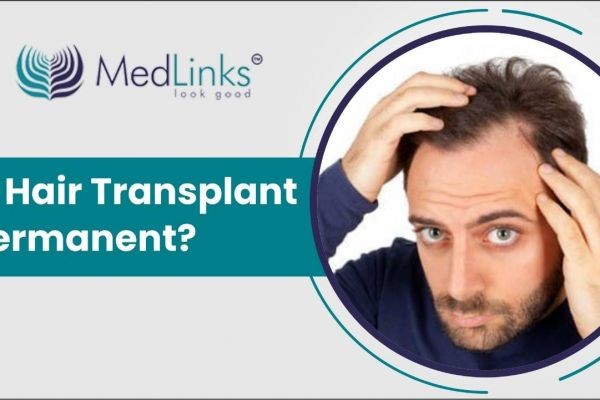 Hair Transplant in Kolkata | Trusted Hair Transplant in Delhi Experts